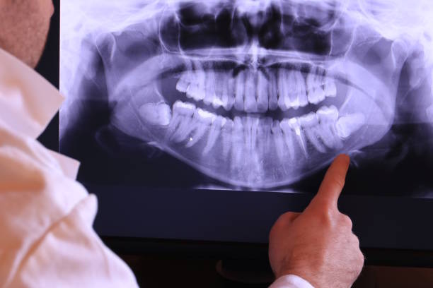Best Walk-In Emergency Dental Services in Barberton, WA