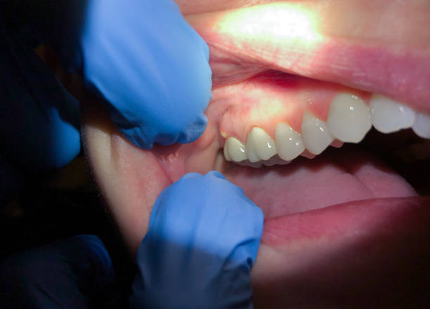 Best Emergency Cosmetic Dentistry (e.g., broken veneers) in Barberton, WA