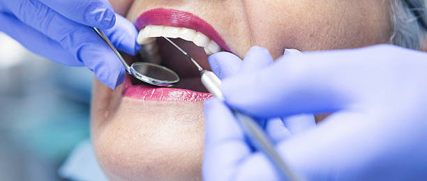 Best Emergency Root Canal Therapy in Barberton, WA